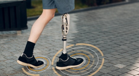 Beinprotese sammelt Daten
